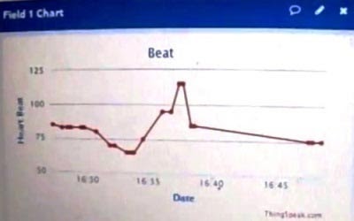 Heart Beat Monitoring over Internet using Arduino and ThingSpeak - source illustration from page 760 Heart Beat Monitoring over Internet using Arduino and ThingSpeak - source illustration from page 760