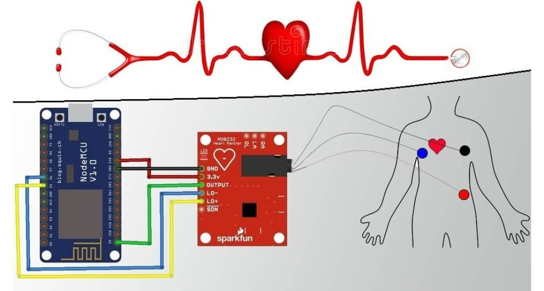 IoT ECG Monitoring with AD8232 ECG Sensor & ESP8266 - source illustration from page 1206 IoT ECG Monitoring with AD8232 ECG Sensor & ESP8266 - source illustration from page 1206