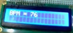 Heart Beat Monitoring over Internet using Arduino and ThingSpeak - source illustration from page 760 Heart Beat Monitoring over Internet using Arduino and ThingSpeak - source illustration from page 760
